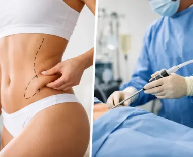 Body Contouring vs Liposuction for Your Goals