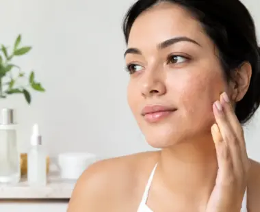 Acne Scar Treatments That Match Your Skin | Laser Aesthetics AZ Acne Scar Treatments That Match Your Skin