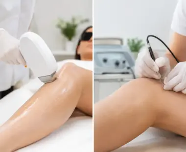 Laser Hair Removal Versus Electrolysis: Which Works?